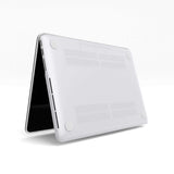 Sweet Treat MacBook Case - Case4You