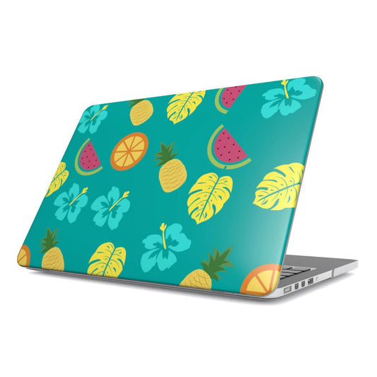 Tropical Breeze MacBook Case - Case4You